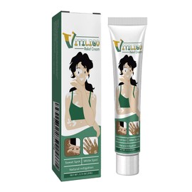 Mnozreo Vitiligo-Behandlungscreme, Vitiligo Repigmentierende Pflegecreme, Vitiligo Pflegecreme für die Haut, Repigmentierungspflege, Creme zur Behandlung von weißen Flecken, 20 g, 1 Stück