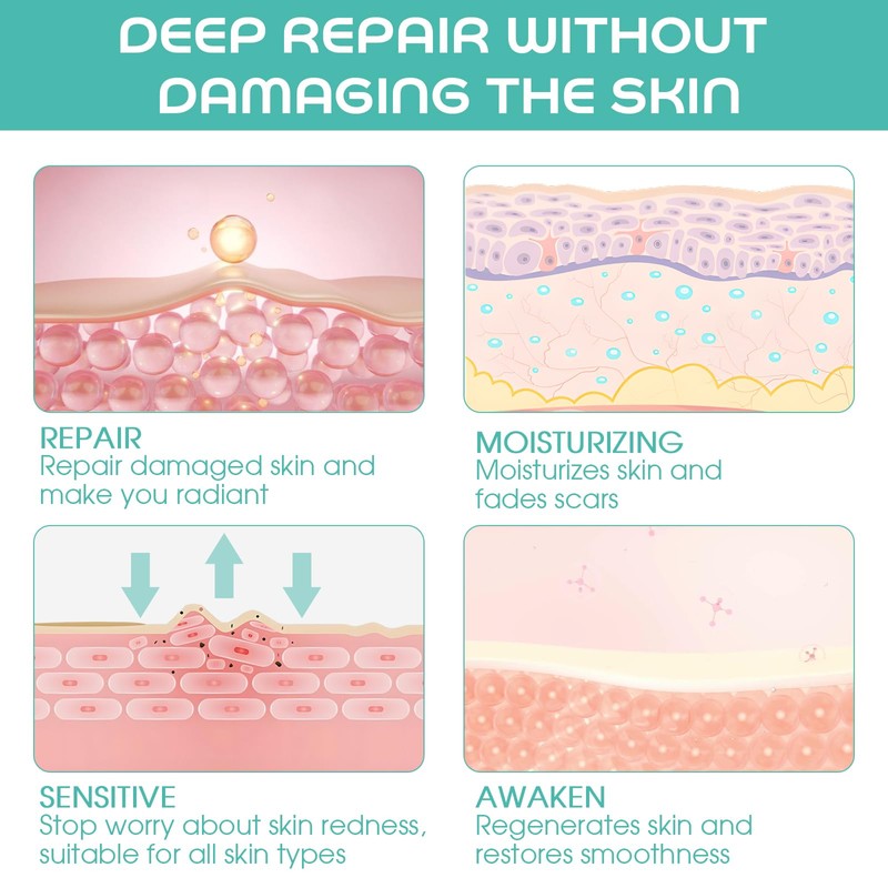 YRVHCK Medical Grade Soft Silicone Tape for Scar Removal (1''x