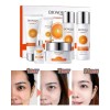 Set Skincare Cuidado Facial Vitamina C Desmancha 6pzs Nuevo