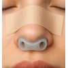 Nostril Retainer for Rhinoplasty Recovery – Soft Silicone Nose Shaper