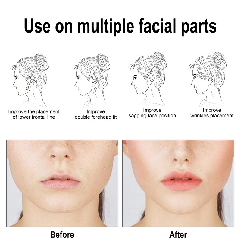 V-Line Lifting Band Facial Lift Patch