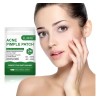 Parche Para Acné + Absorbe Grasa Cicatriza Rápido | Kit