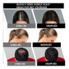 Polvo De Maquillaje Fibra Capilar Cubre Raíz De Cabello