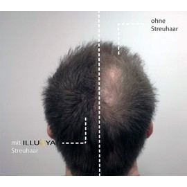 Illusya® Scatter Hair – Hair Fibres for Thickening Hair Premium brand. Full hair in seconds!