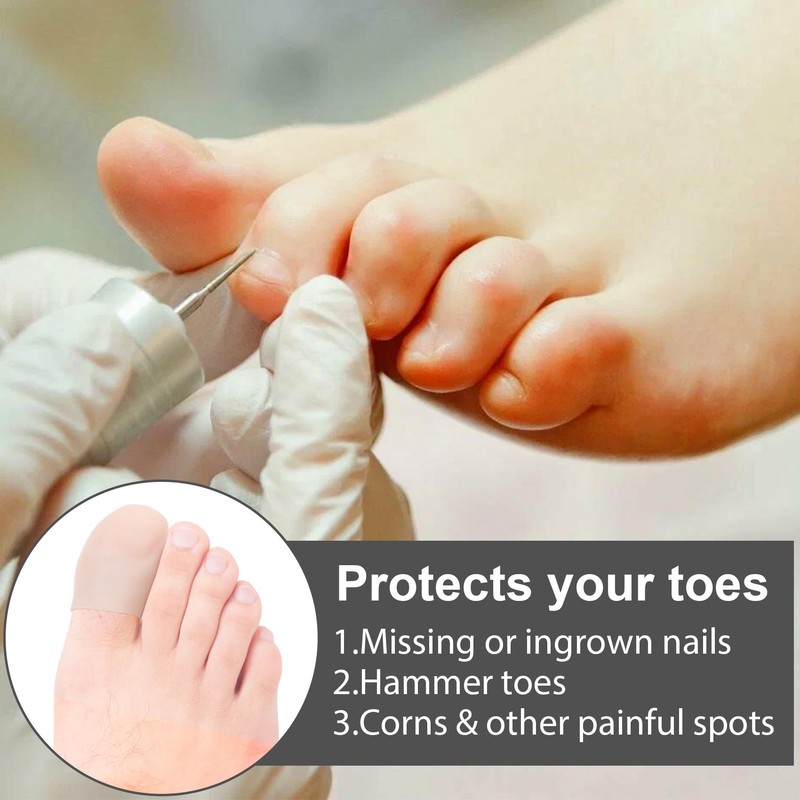 STSTR 10 PCS Soft Gel Toe Caps, Elastic Toe Protectors