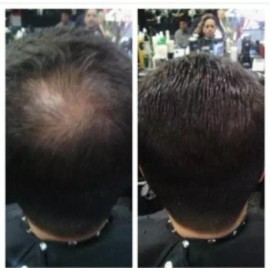 Hair illusion 5x Hair Thickening Fibers by HAIR ILLUSION Bald Thinning Scalp Concealer Fiber - Jet Black