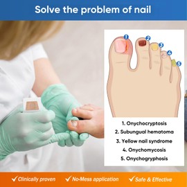 32 Pcs Nail Repair Patches, Nail Repair for Damaged Nails and Appearance of Discolored