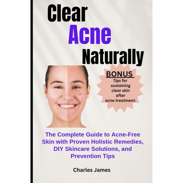 Clear Acne Naturally: The Complete Guide to Acne-Free Skin with