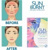 Sunburnt Ultra-hydrating Face Sheet Mask (4 Single Use Masks