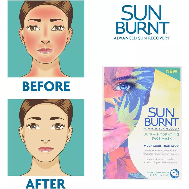 Sunburnt Ultra-hydrating Face Sheet Mask (4 Single Use Masks