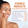 Palmer Crema Facial Anti Manchas Oscuras Vitamina Niacinamida