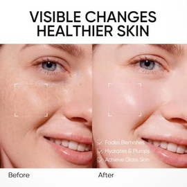 SKINTIFIC Gel Hidratante PDRN Radiante y Suave, 30 g, Crema Facial