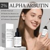 Alpha Arbutin 2% Serum, Niacinamide Serum Pigmentflecken Entferner Gesicht, Alpha