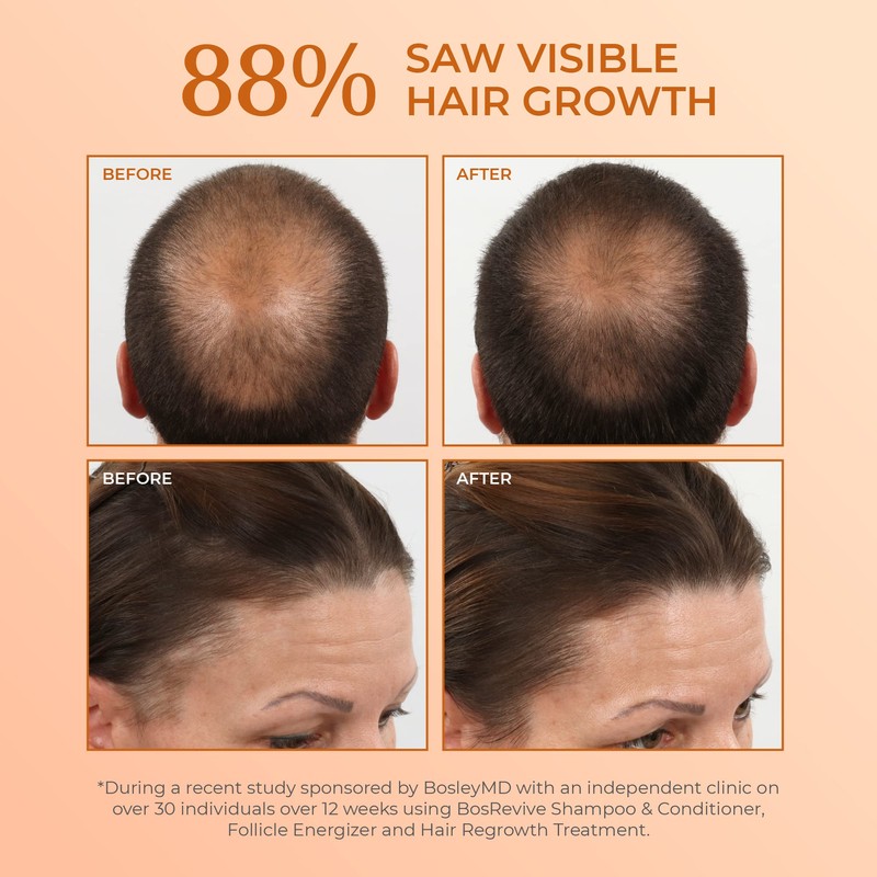 BosleyMD BosRevive KIT for Visible Hair Thinning (Color Safe), Starter