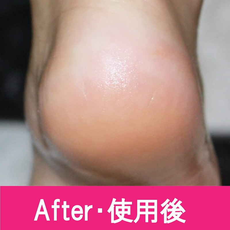 Perfect NAILS Foot File, Foot Care, File, Waterproof, Exfoliating, Exfoliating,