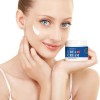 Crema De Urea 40%, Para Pies Secos Agrietados, Talones, Rodi