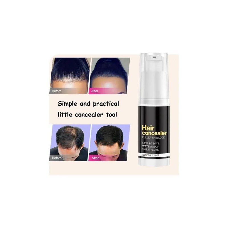 Corrector De Cabello Hairfillup Para Hombre, Hairfillup Hair