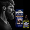 Aceite Para Hacer Crecer La Barba Y Bigote Rapido Natural