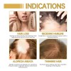 Para 4pcs Aceite Esencial Para Cuidado Del Cabello Veganic
