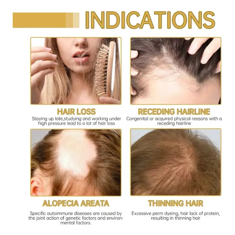 Para 4pcs Aceite Esencial Para Cuidado Del Cabello Veganic