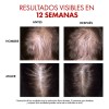 Sérum Regenerador Capilar Dercos Aminexil Booster 90ml Vichy