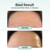 Overnight Use Korean Advanced Forehead Smoothing Patches - Premium Hydrogel