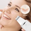 Rio Ultrasonic Skin Cleanser