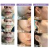 ACSEN AC Spot Solution, Concentrated Spot Serum, 72% Centella Asiatica
