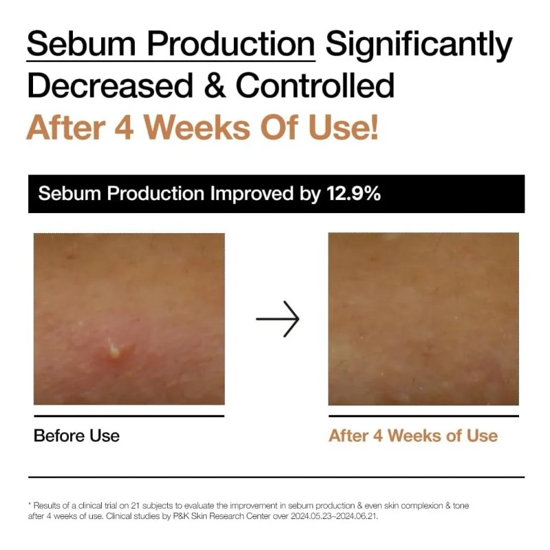 Anua Tónico Lechoso De Arroz 70