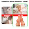 Electric Foot Callus Remover for Feet, Electric Foot File Callus