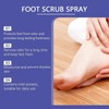 1/2/4pcs Ximonth Foot Care Spray Dry Skin Moisturizing Odor Removal