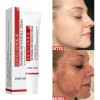 Crema Despigmentante Anti Manchas Zoo·son 20g