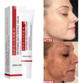 Crema Despigmentante Anti Manchas Zoo·son 20g