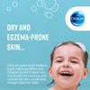 Oilatum Junior Cream for Eczema and Dry Skin Conditions 150g