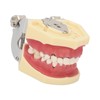 Periodontal Disease Teeth Resin Model Dental Demonstration Teeth Model for