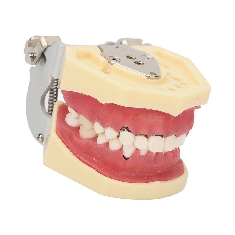 Periodontal Disease Teeth Resin Model Dental Demonstration Teeth Model for