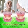 SmileFix Deluxe Dental Repair Kit - Color Matching Compound -