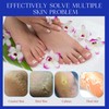 SALVMARY Disposable Pumice Stone for Feet Hard Skin Callus Remover