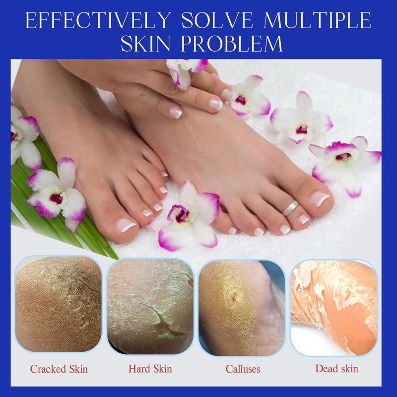 SALVMARY Disposable Pumice Stone for Feet Hard Skin Callus Remover