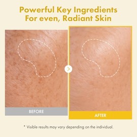 TOSOWOONG Real Kojic Acid Turmeric Fit, Dark Spot Wrapping Mask, Vitamin C & Glutathione Peel Off Facial Mask for Even Tone, Elasticity, Hydrating, Gl