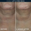 Roc Derm Correxion Neck Cream With Hyaluronic Acid +