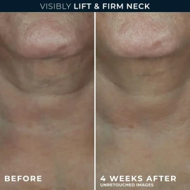 Roc Derm Correxion Neck Cream With Hyaluronic Acid +