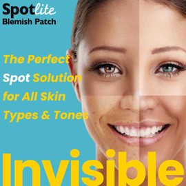 SpotLite Pimple Patches – Pack of 36, CICA & Tea Tree Oil Hydrocolloid Spot Patches, Invisible Face Dots for Spot & Acne Treatment, Fast-Acting, Korean Skincare, Stocking Filler Gift Idea, 10 & 12mm