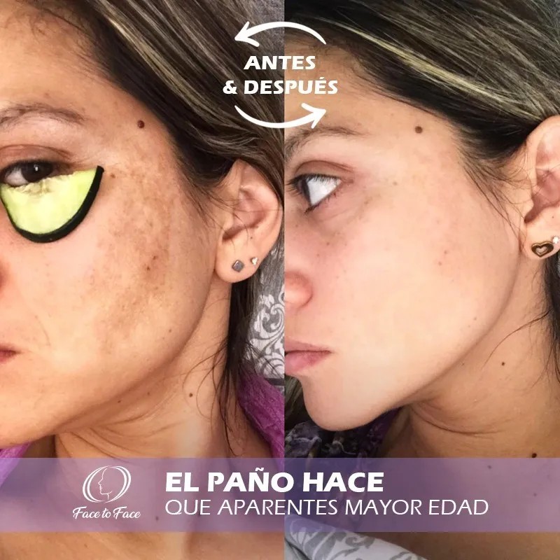 Crema Face To Face Clean Rostro, Quita Manchas, Acné, Paño.
