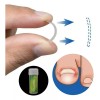 Universo en Linea Kit Corrección Uñas Enterradas Corrector Uñas Encarnadas