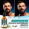 Beard Growth Oil - 2X Concentration Biotin Beard Oil for
