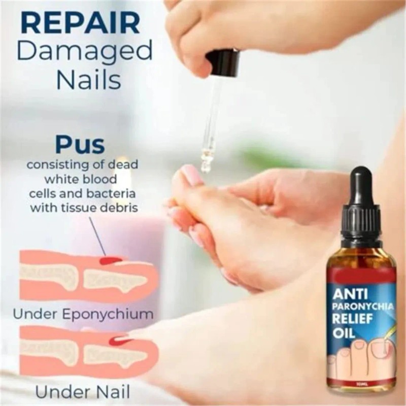 Tratamiento Reparador De Uñas De Pies Y Manos, Gotas De