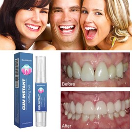 West&Month Gum Repair Therapy Gel, Gum Care Gel, Gum Therapy Gel, Gum Therapy Gel Gum Therapy Gel for Recessed Gums,Caberi - Specification: 1pcs