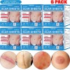 DERMFREE 6x Silicone Scar Sheets Gel Scar Patch Self-Adhesive Scar