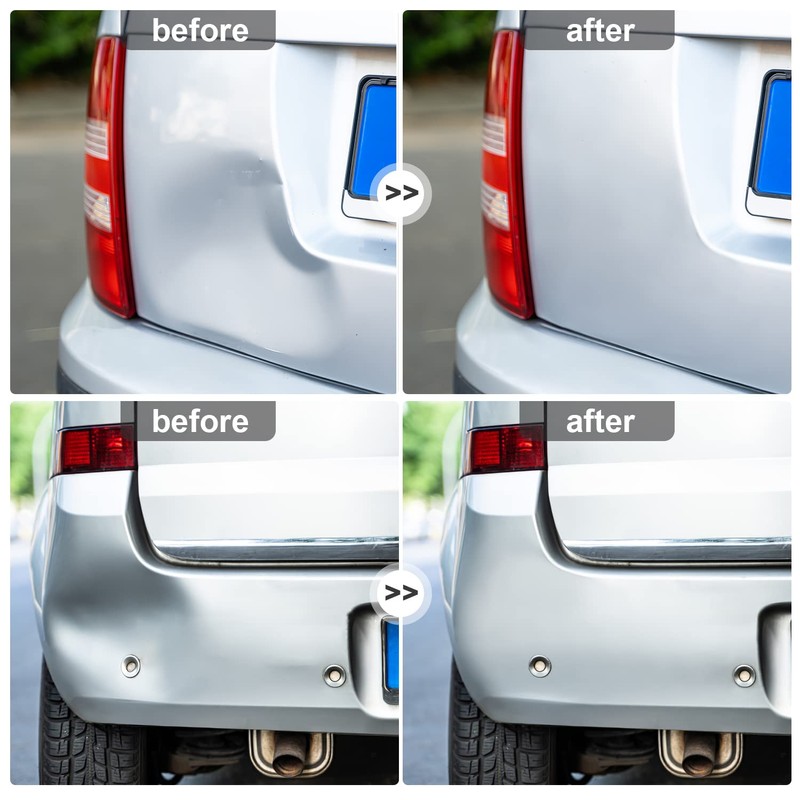Clemas Car Dent Puller Removal Kit, 3 Pcs Dent Remover